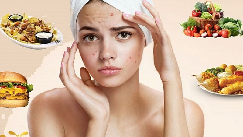 những thực phẩm gây mụn